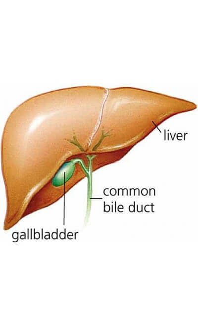 Gall Stones